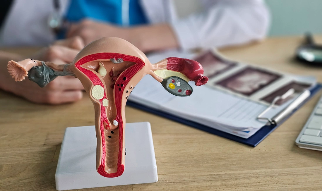 A woman holding an anatomical model of the female reproductive system