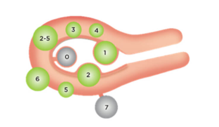 Hysterosalpingography